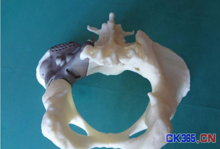 骨组织3D打印技术打印，成为骨再生的未来希望