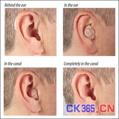 耳背式(BTE)、耳内式(ITE)、耳道式(ITC)和完全耳道式(CIC)助听器，Starkey Laboratories, Inc.授权照片。